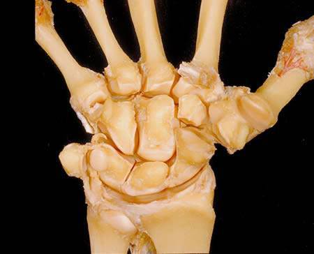 The Human Body - A Dissection (Not for Weak Hearted People)