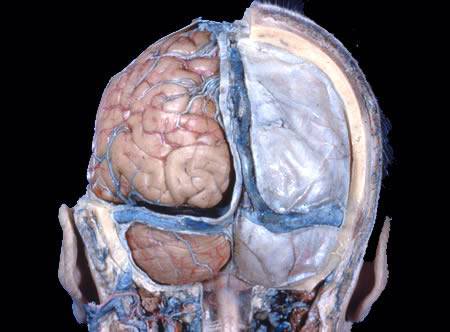 The Human Body - A Dissection (Not for Weak Hearted People)