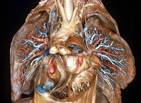 The Human Body - A Dissection (Not for Weak Hearted People)