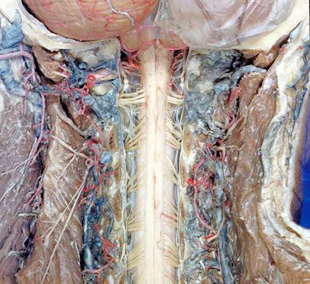 The Human Body - A Dissection (Not for Weak Hearted People)