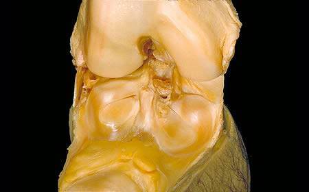 The Human Body - A Dissection (Not for Weak Hearted People)